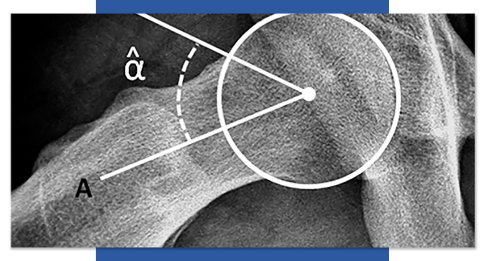 cirugia-reconstructiva---Traumatologo-quito-dr-ronnald-mantilla---traumatologo-ortopedia-rodilla-min